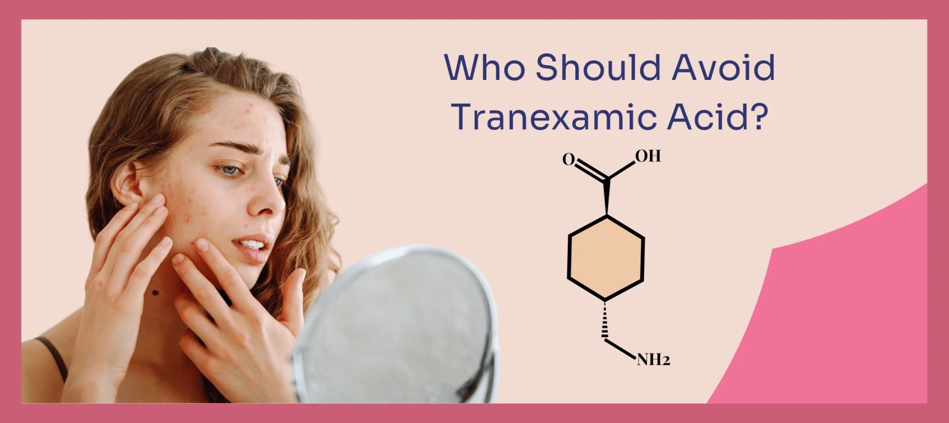 网红“氨甲环酸”被批准用于色斑治疗了吗？